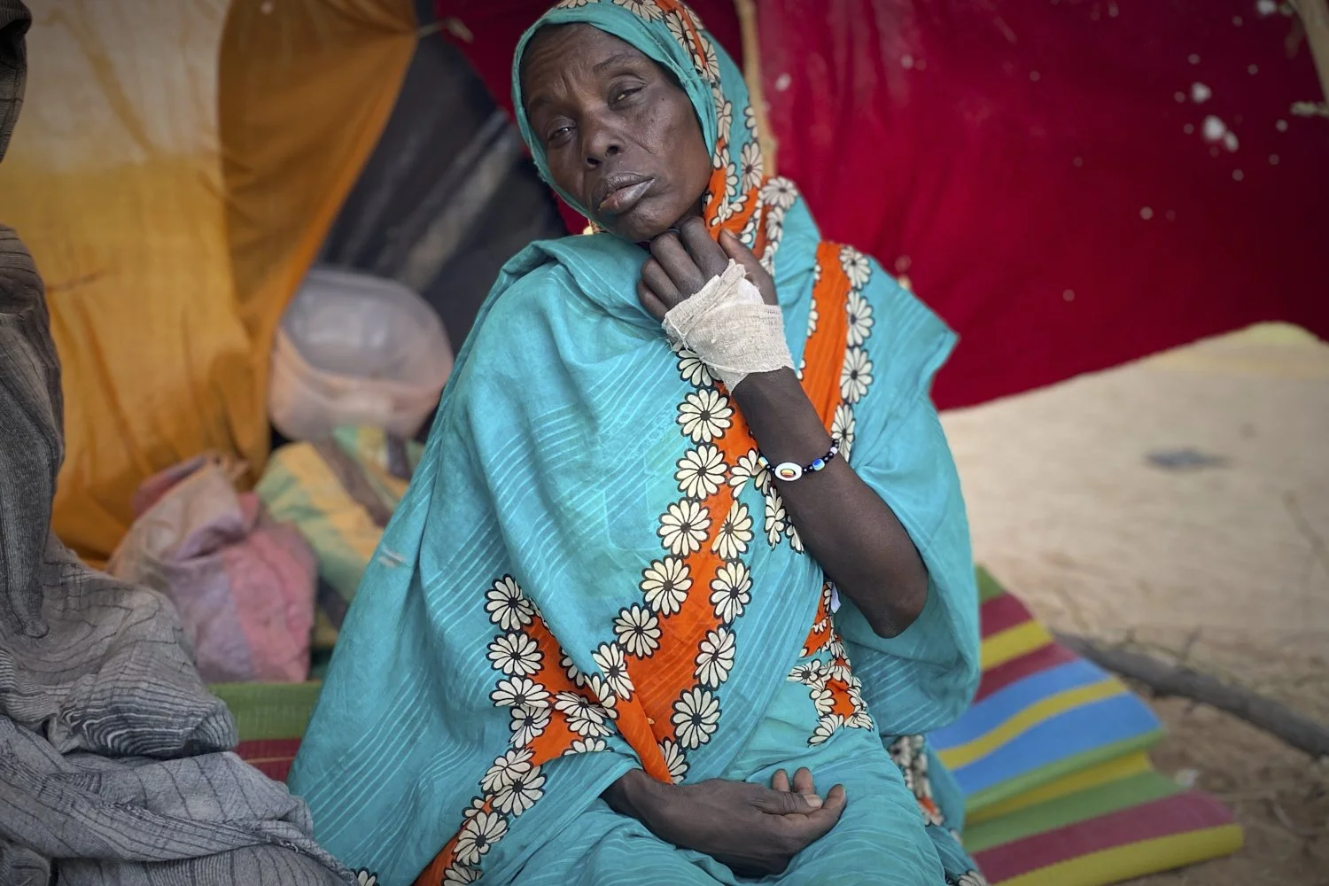  An injured Sudanese woman who fled el-Fasher city, after Sudan's paramilitary forces killed hundreds of people in the western Darfur region, rsits in a tent at a camp in Tawila, Sudan, Friday, Oct. 31, 2025. (AP Photo/Mohammed Bakry) 