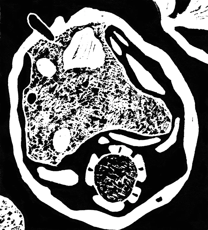 Epidermis Squelch