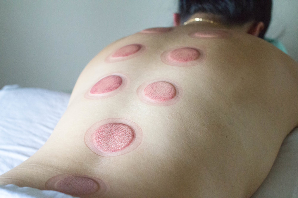 MassageCupping-117.jpg