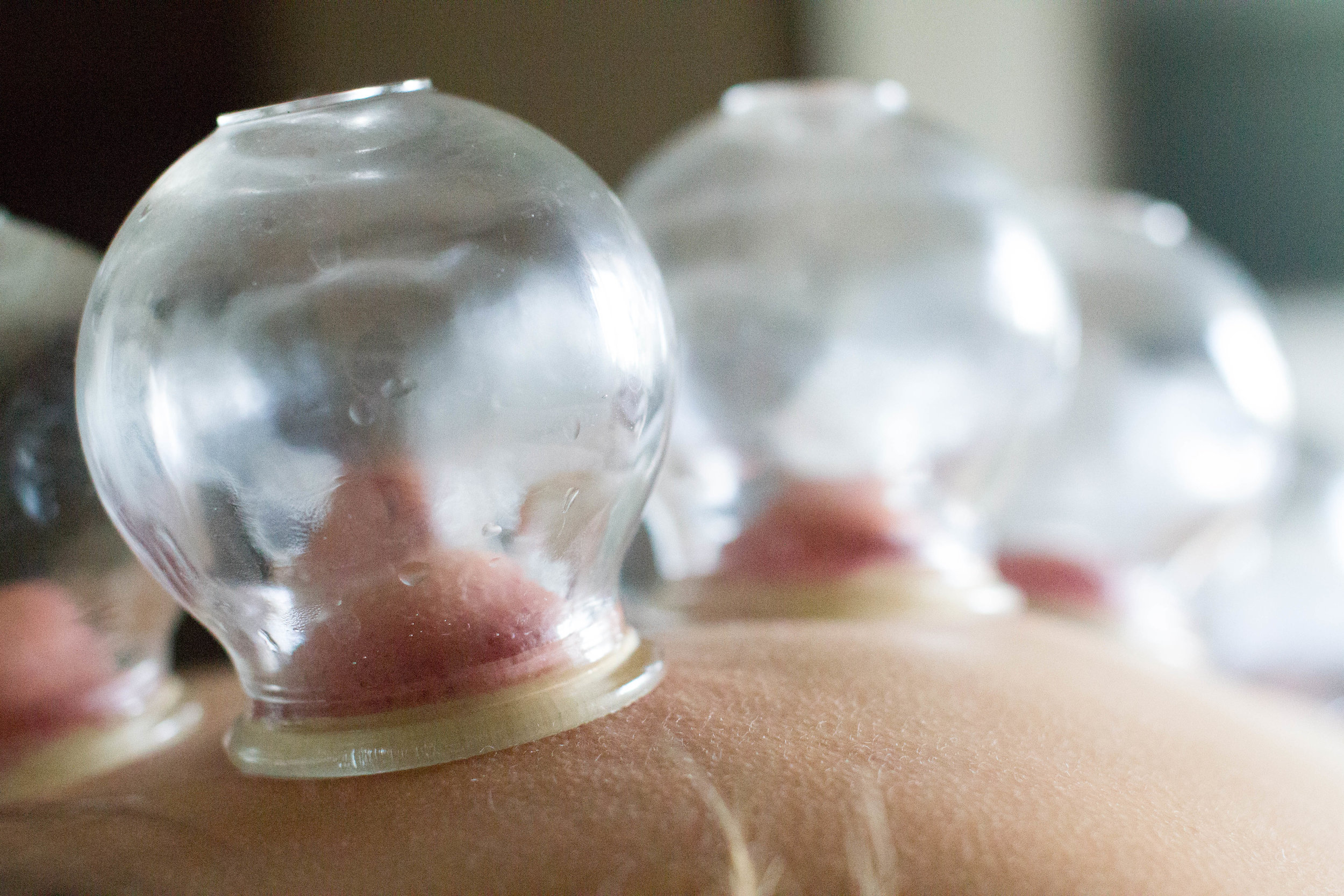 MassageCupping-109.jpg