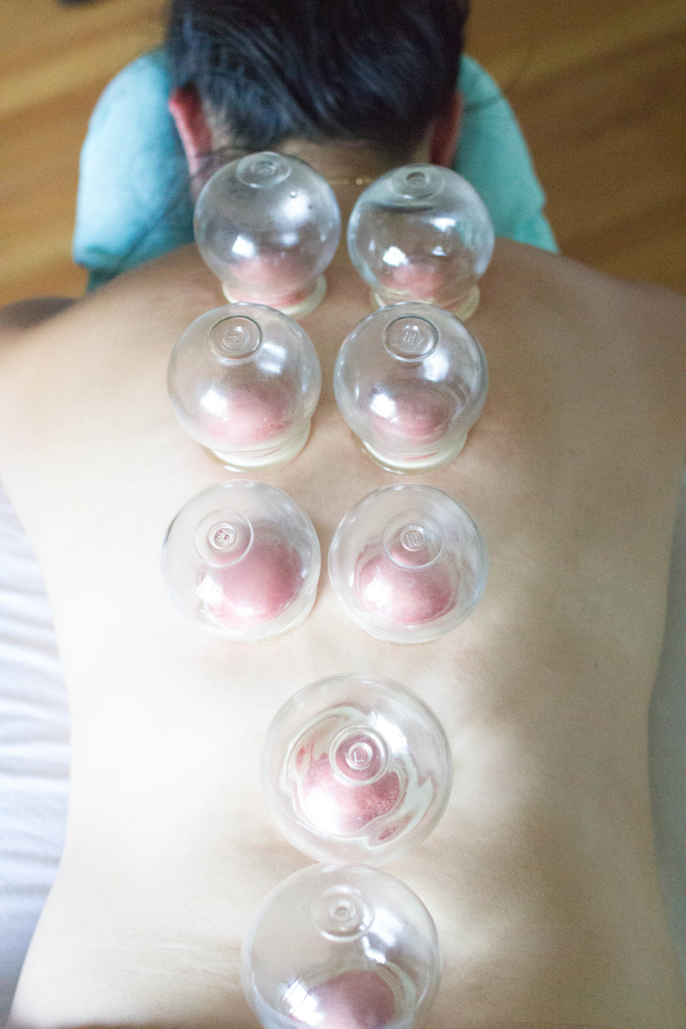 MassageCupping-106.jpg