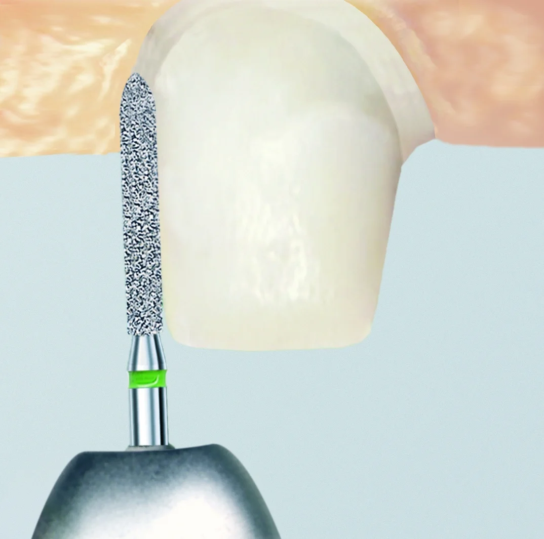 G879.314.014