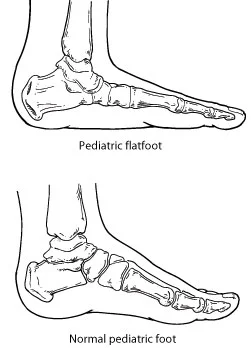 PedFlat03.jpg
