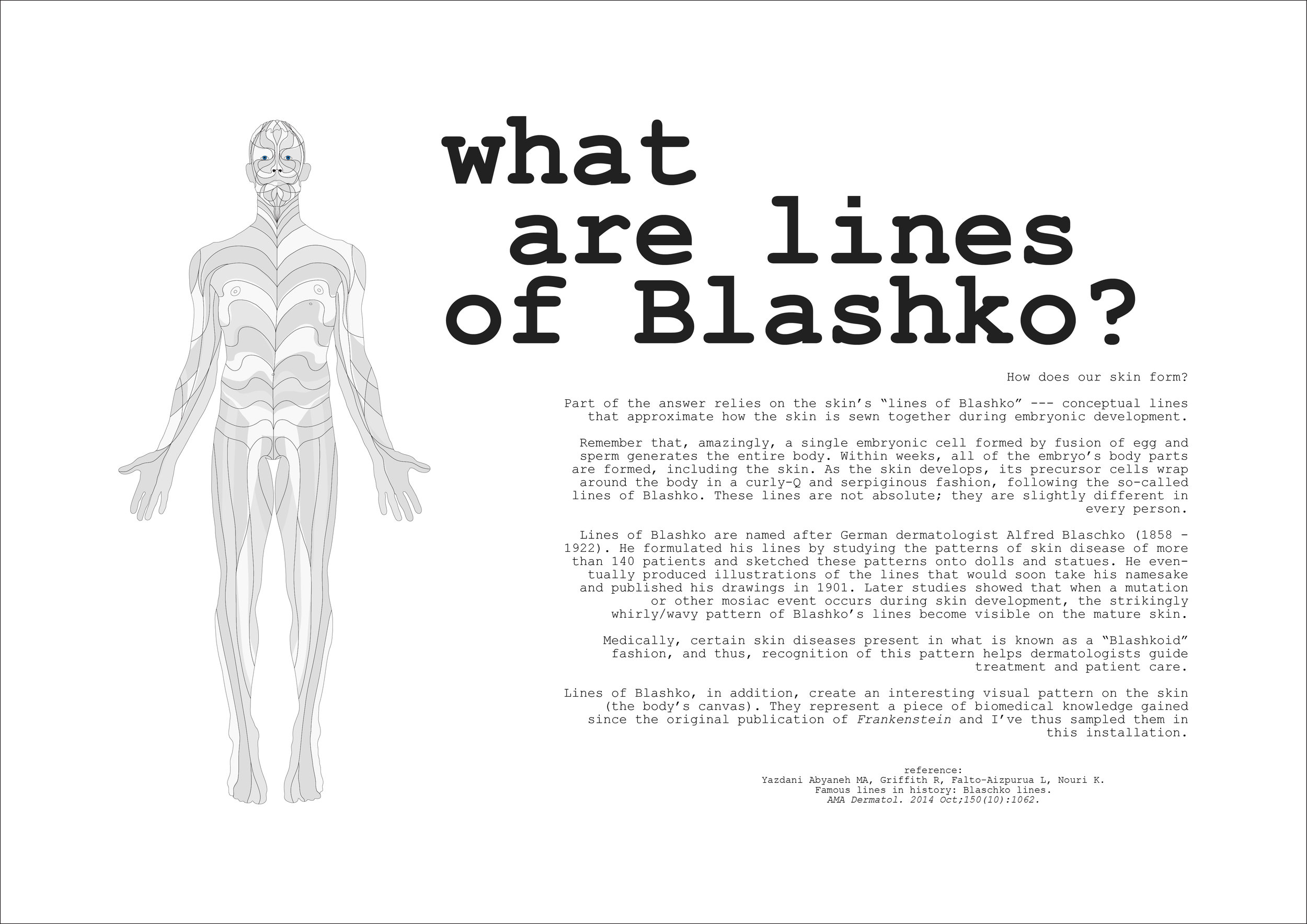 lines of blashko