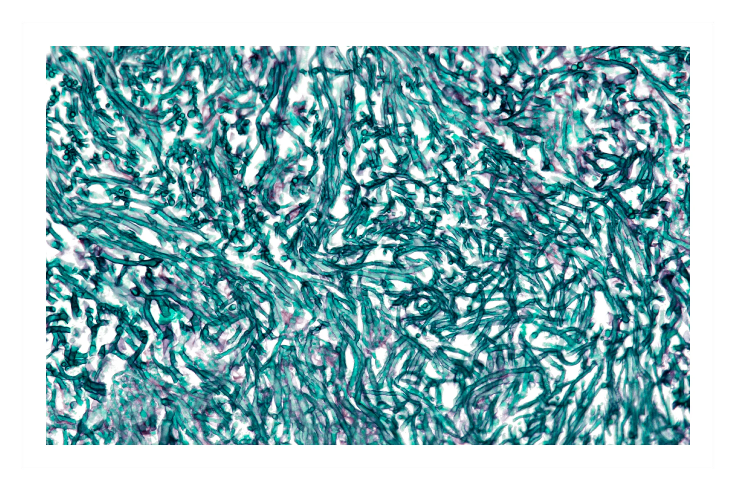 GMS stain-01.jpg