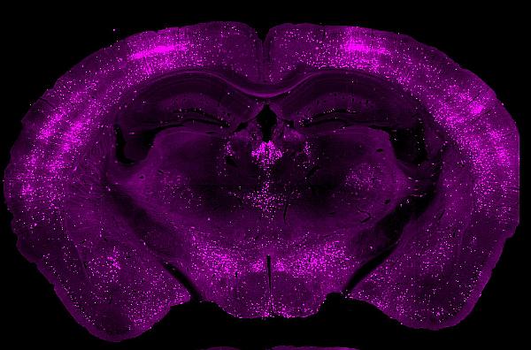 Neurons that have been activated during a behavior throughout the brain can be visualized using TRAP.