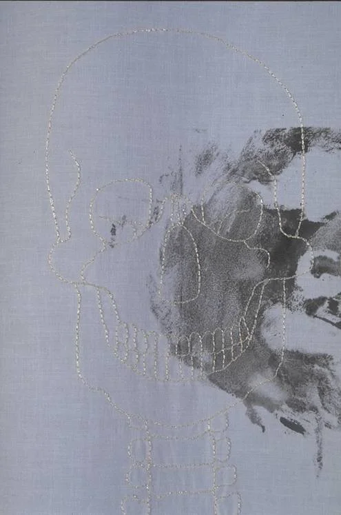 Meical Gaze - 1994