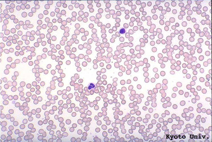 This is an image of a healthy red blood cell count. Circles floating and overlapping. 