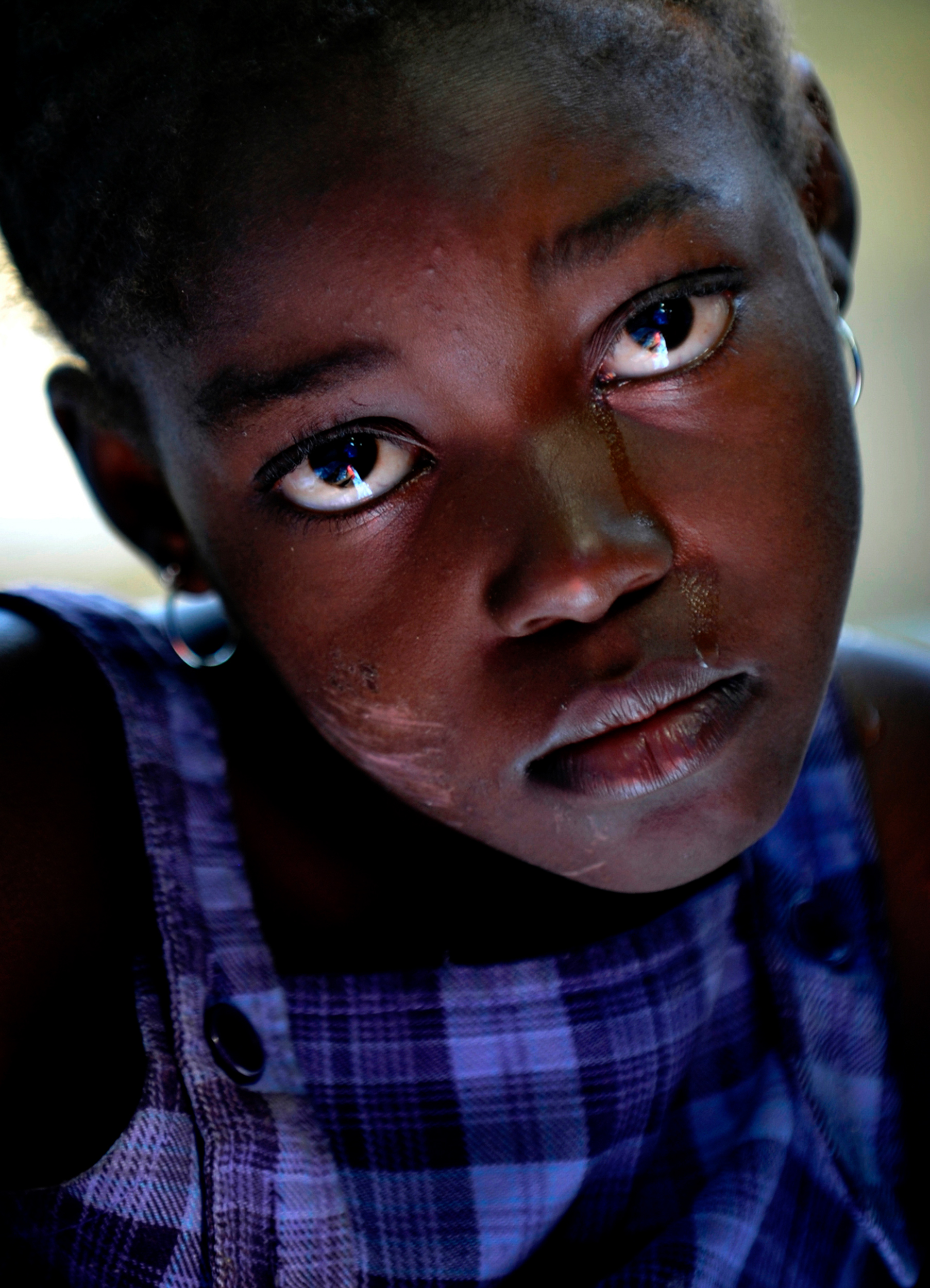 A single tear streams down a young Haitian girl's cheek as she is treated at a small medic station in a refugee camp in Port-au-Prince after the devastating earthquake struck Haiti in January 2010.
