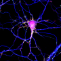 Axonal function of splicing factors in motor development and neurodegeneration
