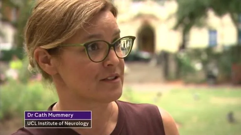 Trial shows signs new Alzheimer's drug could benefit early-stage patients