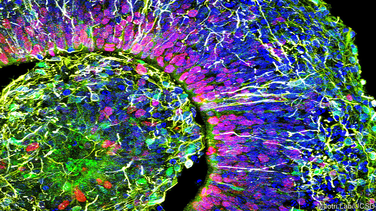 HUMAN BRAIN ORGANOIDS ASSEMBLE FUNCTIONALLY INTEGRATED BILATERAL OPTIX VESICLES