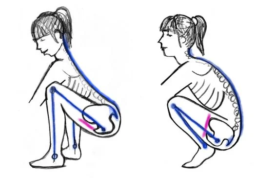 left: uterus supported, right: uterus not supported