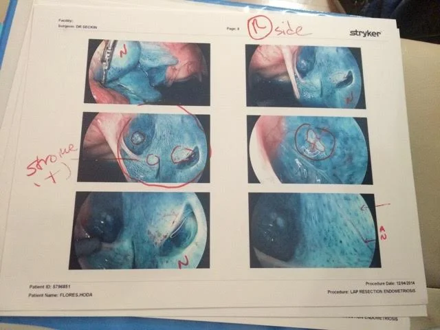 1 of 18 pages of photos provided by Dr. Tamer Seckin- the blue dye highlighting all the endo cells found- December 2014