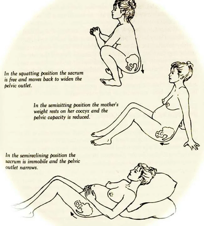 why position is important, especially for those of us with narrow hips. squatting allows the entire pelvic outlet to widen naturally.