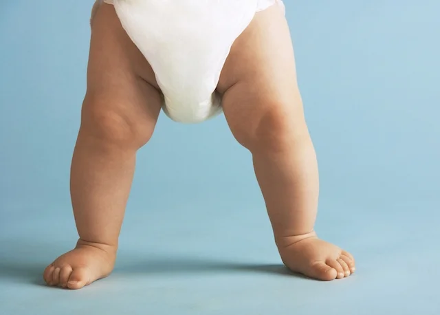 look at those displaced thigh bones!