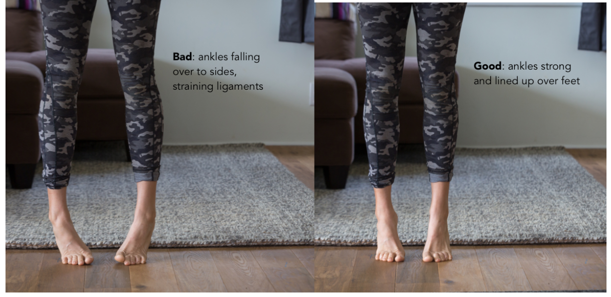 endometriosis_alignment_pelvicfloor.png