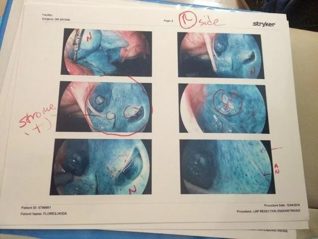 1 of 18 pages of photos provided by Dr. Tamer Seckin- the blue dye highlighting all the endo cells found- December 2014