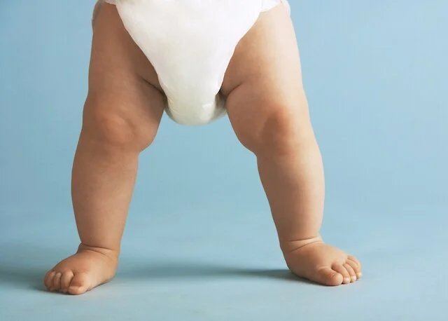 look at those displaced thigh bones!