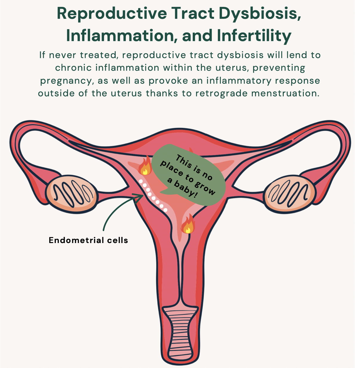 An anatomical diagram of the uterus showing endometrial cells and inflammation, illustrating how reproductive tract dysbiosis prevents pregnancy and provokes inflammatory responses.