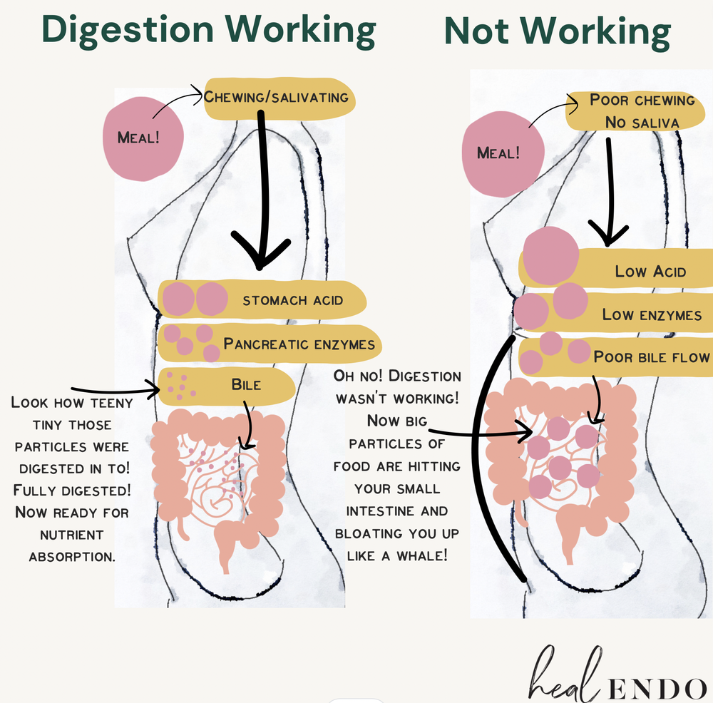 What is Endo Belly Endometriosis Bloat, Digestive Disfunction — Heal Endo