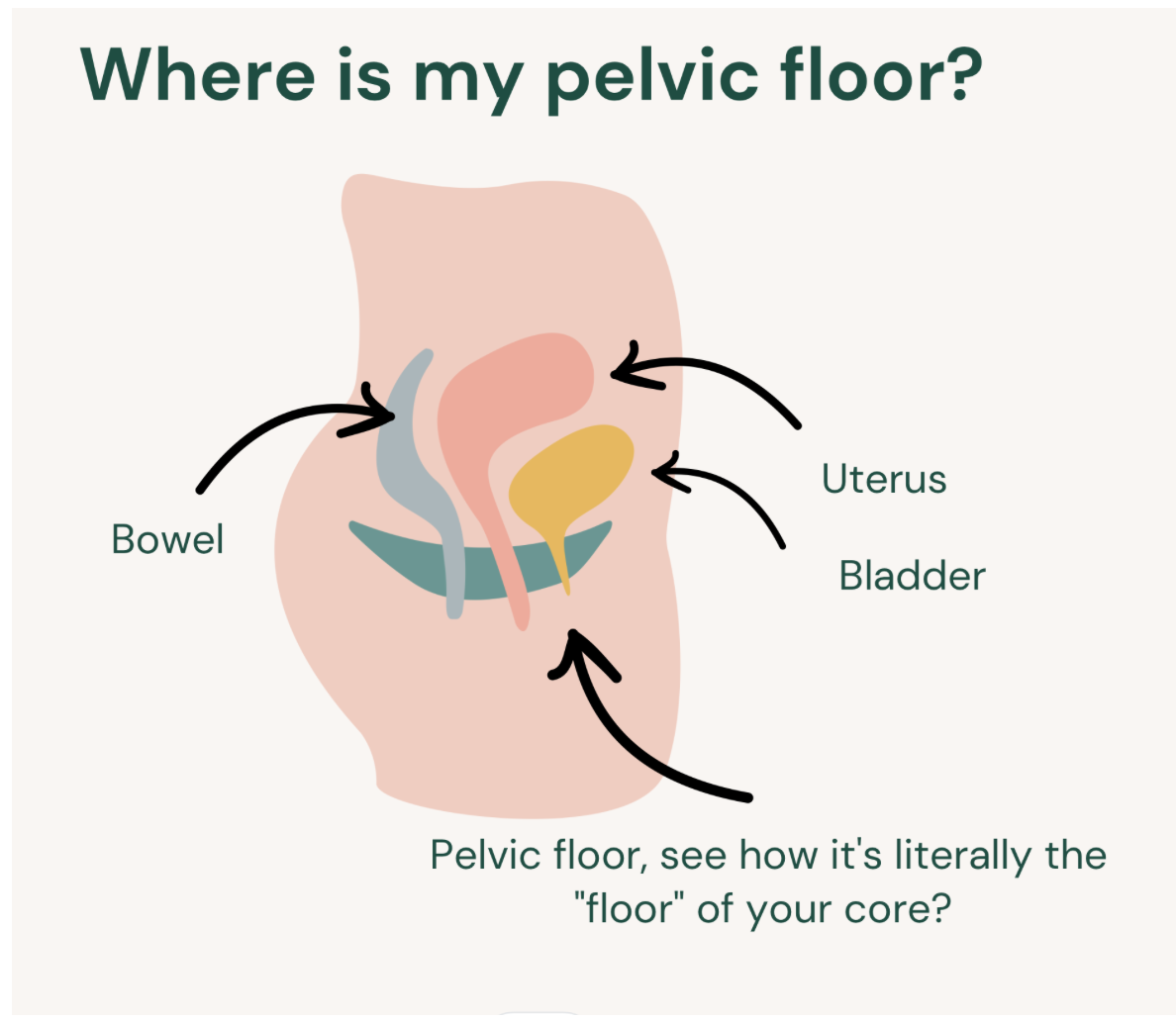 Diagram of pelvic floor muscles showing how pelvic floor dysfunction can contribute to endometriosis pain and chronic pelvic pain