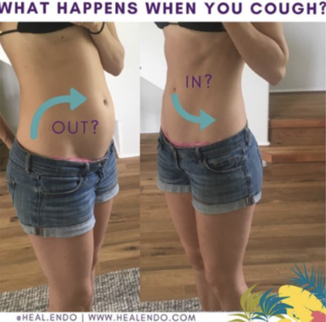 a cough test is a great way to see if your core iis dysfunctional, which can result in a lower belly pooch and endo belly