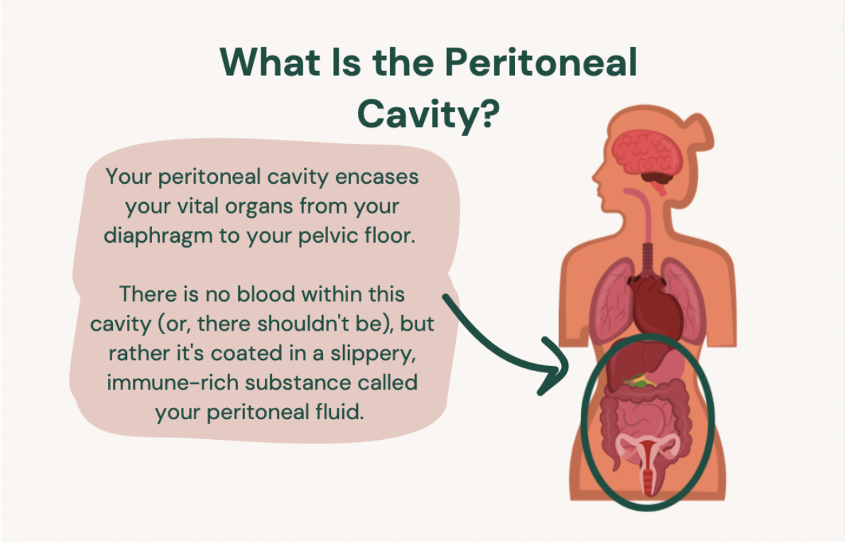 An anatomical diagram of the female torso highlighting the peritoneal cavity, explaining that it encases vital organs and is filled with immune-rich peritoneal fluid.