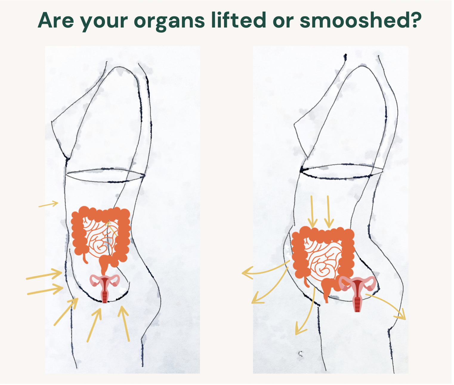 endo belly lower belly pooch endometriosis heal endo