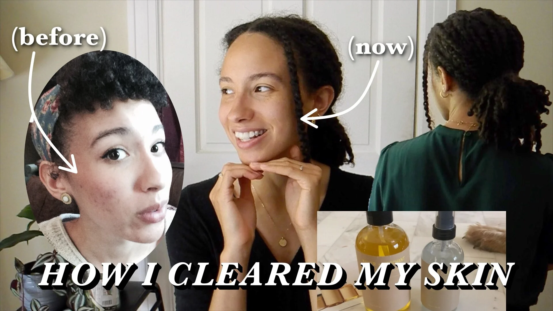 Supportive Skincare Saved My Skin