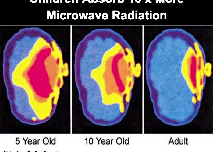 Saturation of a child skull compared to an adult