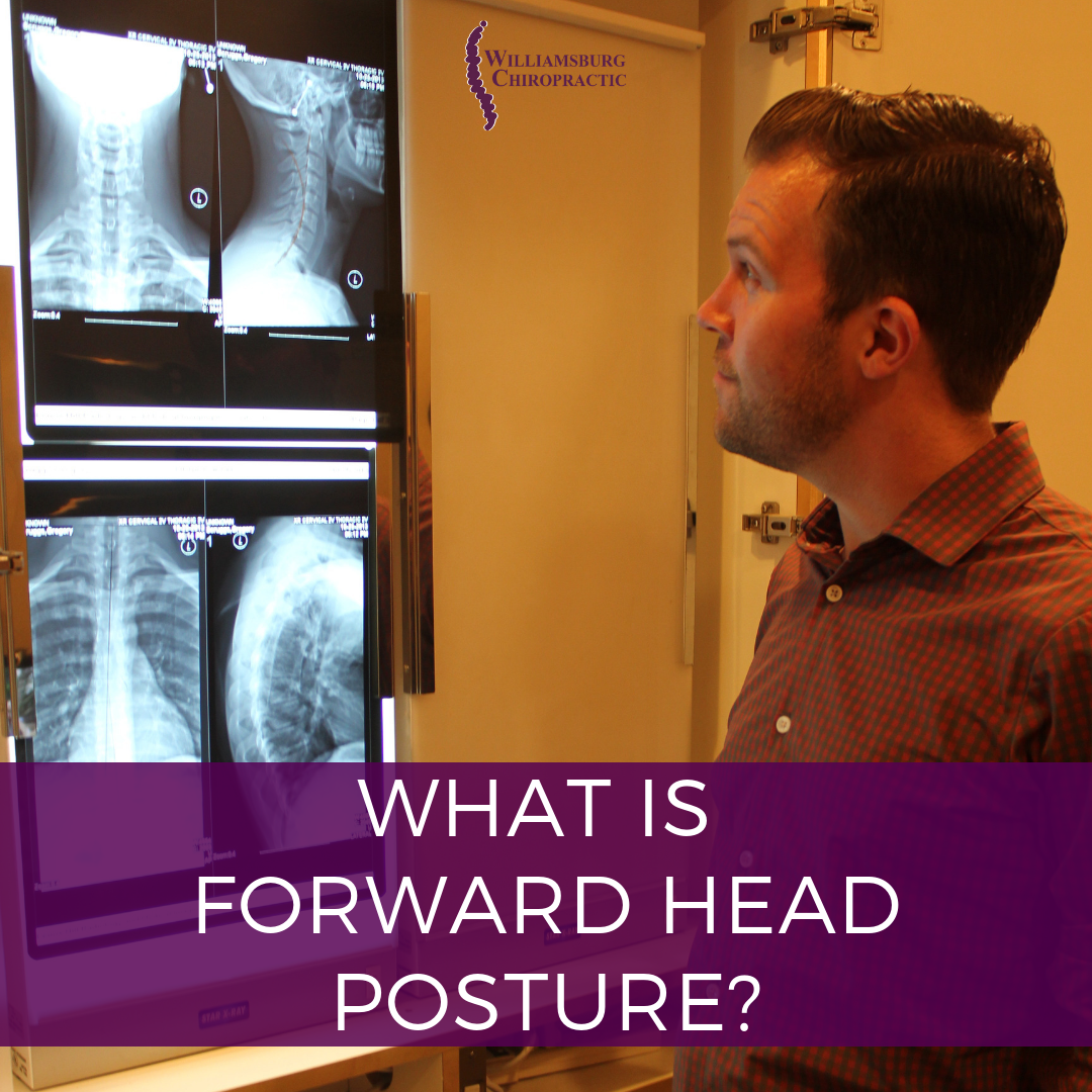 Tips for Forward Head Posture — Williamsburg Chiropractic