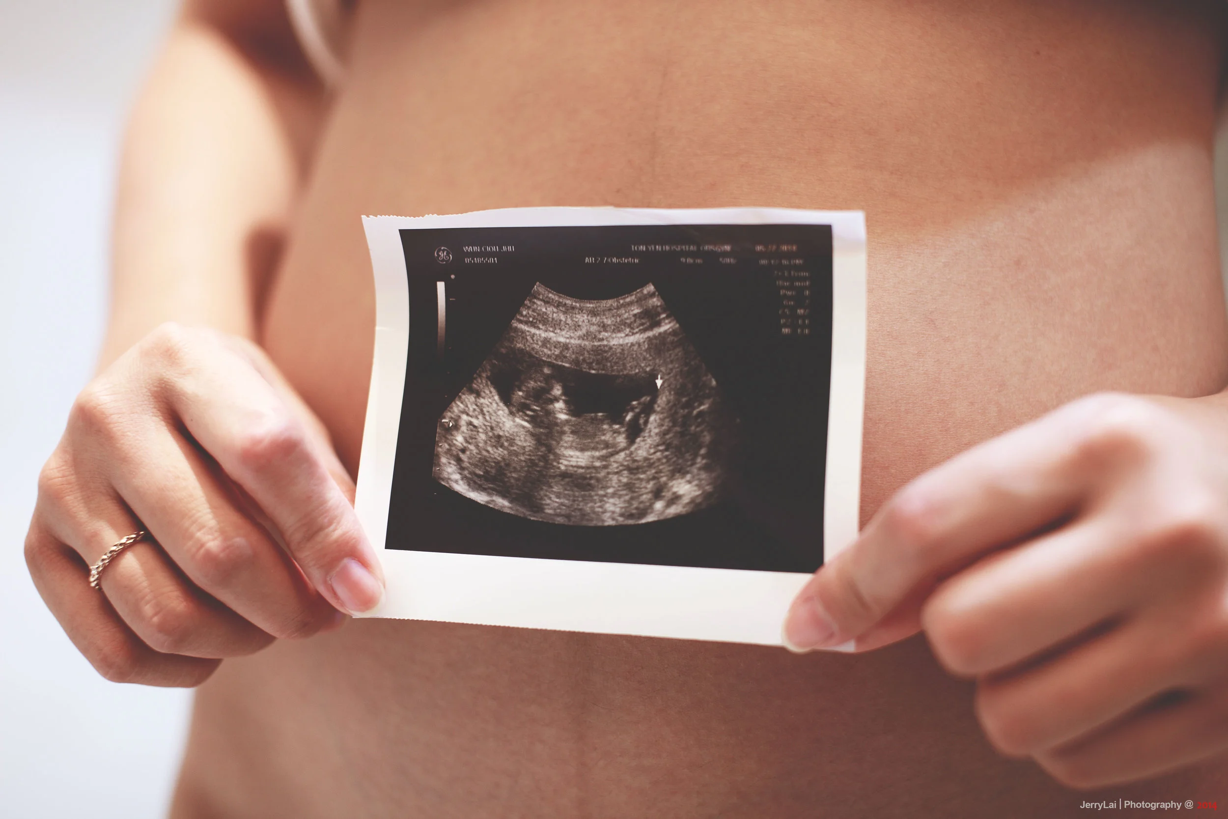 Nutrition & Health Care Professionals:#3  Does Your OB/GYN Take Vitamins and Supplements? Why?