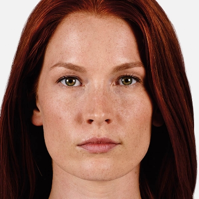 Before - Lips