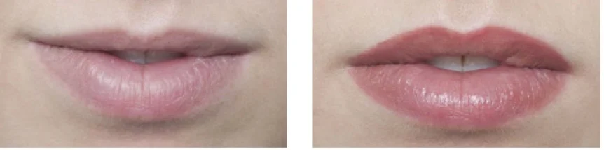 LIPS_4.jpg