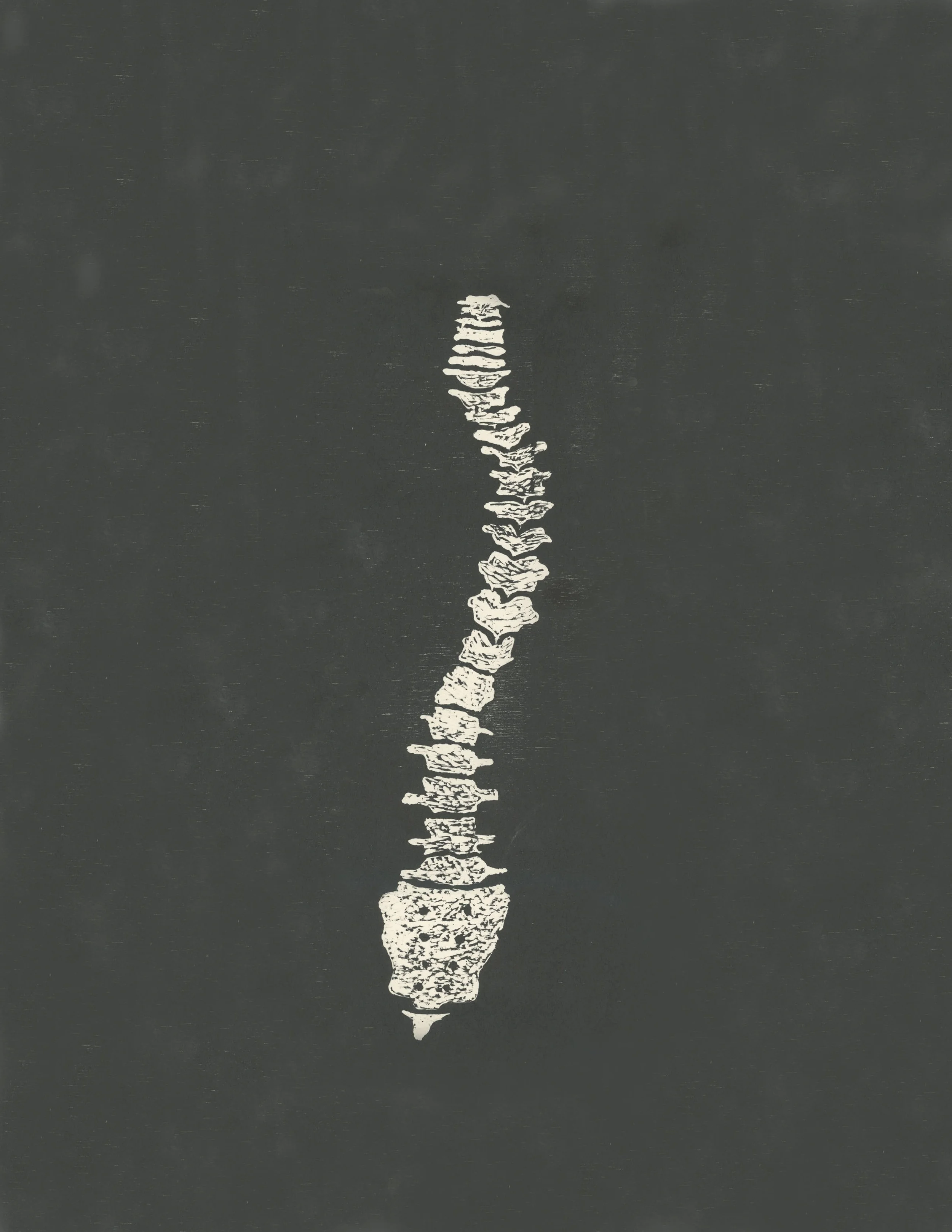 spine.jpg