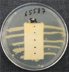 Résultat d'essai AATCC 147 contre la souche bactérienne S.Aureus pour un tissu non-traité de référence
