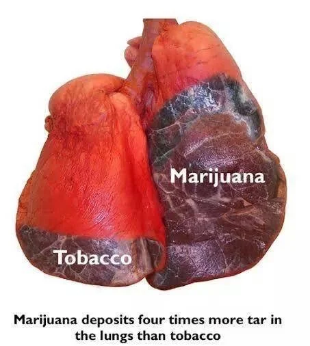 Marijuana_Lungs.jpg