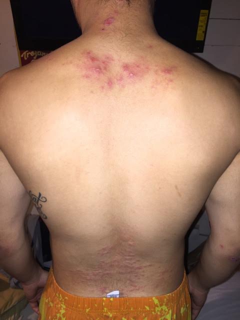 His back before.