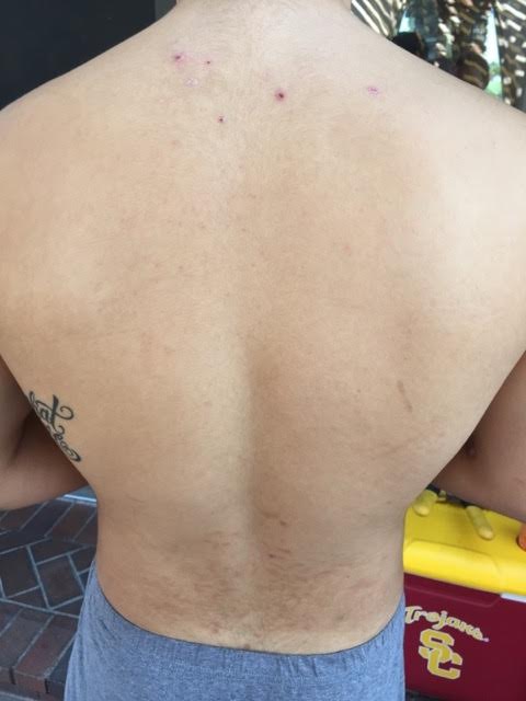 His back after.