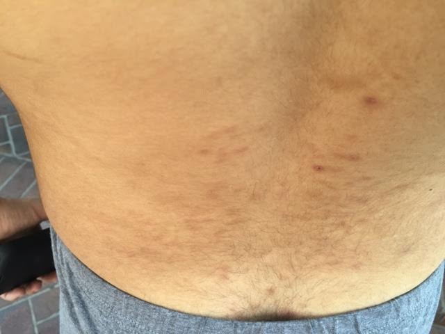 His lower back after .