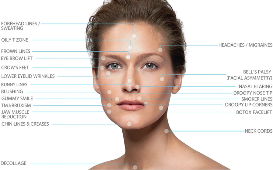 INDICATIONS FOR THE INJECTION OF BOTOX COSMETIC