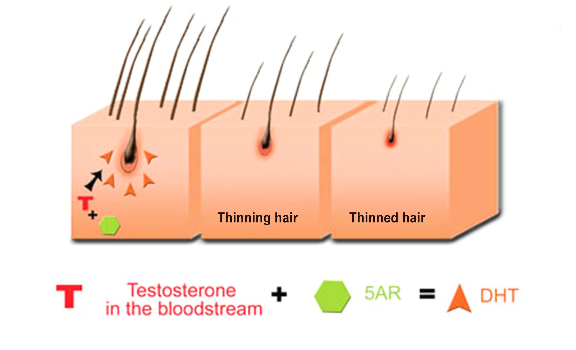 Как удалить с волос тестостерон