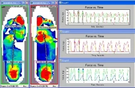 and what have we been saying? Gait problems leave clues. Asymmetry is a BIG clue “Asymmetrical lower extremity neuromuscular control is predictive of repetitive stress injury in recreational runners, according to findings presented at the Combined Sections Meeting of the American Physical Therapy Association in February in Anaheim.” http://lermagazine.com/issues/march/years-after-achilles-tear-injured-limb-demonstrates-elevated-knee-loading