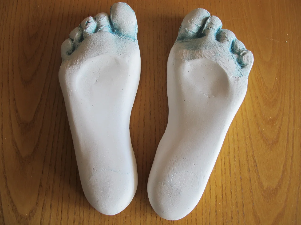 Custom orthotic or Sham for mid tendon achilles tendonopathy? It doesn’t seem to matter. This study prescribed eccentric calf exercises along with either a custom or “sham” foot orthosis for 140 people who were randomized as to which group got the real goods and which one did not. A Victorian Institute Sports Assessment-Achilles questionairre was given at baseline, 1, 3, 6 and 12 months. No statistically significant difference between the groups. Hmmm.. We wonder just what were the custom and sham like? When we use orthoses, we use full arch contact devices. Perhaps the type of orthosis makes a difference? What has been your experience? Munteanu SE, Scott LA, Bonanno DR, Landorf KB, Pizzari T, Cook JL, Menz HB. Effectiveness of customised foot orthoses for Achilles tendinopathy: a randomised controlled trial. Br J Sports Med. 2015 Aug;49(15):989-94. doi: 10.1136/bjsports-2014-093845. Epub 2014 Sep 22.