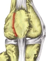 Patello femoral pain? Thinking weak VMO? Think again… “Atrophy of all portions of the quadriceps muscles is present in the affected limb of people with unilateral PFP. There wasn’t any atrophy of the quadriceps in individuals with PFP compared to those without pathology. Selective atrophy of the VMO relative to the vastus lateralis wasn’t identified in persons with PFP.” http://www.physiospot.com/research/atrophy-of-the-quadriceps-is-not-isolated-to-the-vastus-medialis-oblique-in-individuals-with-patellofemoral-pain/
