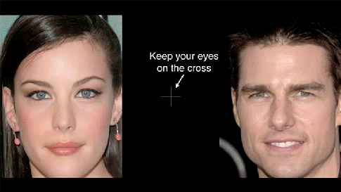 Your gait and peripheral vision: Part 2. There is more to it than what you do/don’t see. Written by Dr. Shawn Allen Yesterday we did a blog post on the loss of peripheral vision from drooping eye lids leading to the necessity (not vanity based) of a minor surgical procedure called a blepharoplasty. Here was that blog post (link) , it had some important research based points you need to know. Vision is typically the predominant sensory system used for guiding locomotion. Online visual control is critical for adjusting lower limb trajectory and ensuring proper foot placement, including optimal limb/foot crossing velocity, optimal trail-foot horizontal distance and lead-toe clearance. Research suggests that peripheral visual cues play a large role in this online gait control. 1 We have discussed many of these issues, the conscious and subconscious importance of vision on human gait, in many of our blog posts over time. Namely, blog posts on dual-tasking attention, negotiating stairs, and even in tandem walking holding hands. These all require a degree of peripheral vision function otherwise gait problems, including falls, rise on the risk list. According to Timmis and Buckley (2), “although gaze during adaptive gait involving obstacle crossing is typically directed two or more steps ahead, visual information of the swinging lower-limb and its relative position in the environment (termed visual exproprioception) is available in the lower visual field (lvf).” Their study determined exactly when lvf exproprioceptive information is utilized to control/update lead-limb swing trajectory during obstacle negotiation. Their study determined that “when (the) lower visual field (lvf) was occluded, foot-placement distance and toe-clearance became significantly increased; which is consistent with previous work that likewise used continuous lvf occlusion”. Their findings suggest that “ lvf (exproprioceptive) input is typically used in an online manner to control/update final foot-placement, and that without such control, uncertainty regarding foot placement causes toe-clearance to be increased. Also that lvf input is not normally exploited in an online manner to update toe-clearance during crossing: which is contrary to what previous research has suggested.” 2 Elliot and Buckley (3) showed the importance of peripheral visual cues in the control of minimum-foot-clearance during overground locomotion. In their study, From their abstract: “eleven subjects walked at their natural speed whilst wearing goggles providing four different visual conditions: upper occlusion, lower occlusion, circumferential-peripheral occlusion and full vision. Results showed that under circumferential-peripheral occlusion, subjects were more cautious and increased minimum-foot-clearance and decreased walking speed and step length. The minimum-foot-clearance increase can be interpreted as a motor control strategy aiming to safely clear the ground when online visual exproprioceptive cues from the body are not available. The lack of minimum-foot-clearance increase in lower occlusion suggests that the view of a clear pathway from beyond two steps combined with visual exproprioception and optic flow in the upper field were adequate to guide gait. A suggested accompanying safety strategy of reducing the amount of variability of minimum-foot-clearance under circumferential-peripheral occlusion conditions was not found, likely due to the lack of online visual exproprioceptive cues provided by the peripheral visual field for fine-tuning foot trajectory.” These appear to be important studies on the effects of vision and peripheral vision and proprioceptive cues. How we move our bodies depends much on visual cues, the ones we know we see, and the ones we are unaware that we “see”. Take this to the next level, imagine how the blind must adapt to gait without these cues. That is gait topic we will save for another time. So, the gait analysis you are doing with your runners, your athletes, your clients takes into consideration their vision right ? Hmmmm, some how we just know that many gait gurus just sat back in their chairs and let out a long exhale. We go even more rogue in podcast 95 when we discuss head tilt and the vestibular system, we know that one is almost always overlooked. Another long exhale we presume. Shawn Allen … . one of the gait guys References: 1. Exerc Sport Sci Rev. 2008 Jul;36(3):145-51. doi: 10.1097/JES.0b013e31817bff72.Role of peripheral visual cues in online visual guidance of locomotion. Marigold DS 1 . 2. Gait Posture. 2012 May;36(1):160-2. doi: 10.1016/j.gaitpost.2012.02.008. Epub 2012 Mar 17.Obstacle crossing during locomotion: visual exproprioceptive information is used in an online mode to update foot placement before the obstacle but not swing trajectory over it. Timmis MA 1 , Buckley JG . 3. Gait Posture. 2009 Oct;30(3):370-4. doi: 10.1016/j.gaitpost.2009.06.011. Epub 2009 Jul 22.Peripheral visual cues affect minimum-foot-clearance during overground locomotion. Graci V 1 , Elliott DB , Buckley JG .