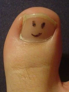 Big Toe Woes: One way to learn to load the head of the 1st metatarsal On Thursday morning, while sprinting up a hill on the latter part of a run, I had the fortuosity of catching my big toe on what I beleive was an exposed root and fell sudddenly. Instinctively I rolled to protect my back (as you often do if you have had any history of back injuries). After a few expletives and a bruised ego, I took inventory of my body: back was fine, an abrasion and contusion on my left elbow and a really sore big toe. I got up and decided to run home as I was less than a mile from there. I immediately noticed that my gait would need to be altered if I was going to make it home. I had injured the distal interphalangeal joint and distal phalanyx from the best I could tell; loading them in any way brought excruciating pain, so I was forced into one of my mantra’s: “Keep your toes up”*. I did this for the rest of my run and noticed, probably more than ever, how much this simple technique shifts the weight to the head of the 1st metatarsal and sesamoids. It also made me make my gait more “circular” (rather than pendular, another thing we teach in gait retraining). I made it home and promptly iced. After getting to the office, an X ray confirmed my suspicion of a fracture in the proximal portion of the distal phalanyx. A day later and from my distal to my 1st metatarsal phalangeal joint is sausage like and a beautiful violet color. I am grateful I did not seem to injure the MTP…Oh well, I will either have to run carefully or switch to mountain biking for the next few weeks. Some ipriflavone (to assist in calcium absorption), cucumin and essentail oils (for inflammation) and I was good to go. Yes it throbs a bit, but it is a reminder that I need to push off through the head of the 1st : ) Try “toes up”with your peeps and let us know how it goes. TGG * “Toes up” technique involves conciously firing the anterior compartment muscles, particularly the extensor digitorum longus. It fires more into the extensor pool and assists in firing ALL your extensors through spacial and temporal summation and also heps to shut down flexor tone through reciprocal inhibition. It will also help you to rocker through your stance phase and get more into your hip extensors.
