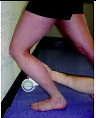 Achilles Tendonitis The motion needs to occur somewhere…Make sure you look at the whole picture Since the knee was bent, perhaps we should be looking at the soleus? And the talo crural articulation? “A more limited ankle Dorsi Flexion Range Of Motion as measured in Non Weight Bearing with the knee bent increases the risk of developing Achilles Tendonitis among military recruits taking part in intensive physical training.” J Foot Ankle Res. 2014 Nov 18;7(1):48. doi: 10.1186/s13047-014-0048-3. eCollection 2014. Limited ankle dorsiflexion increases the risk for mid-portion Achilles tendinopathy in infantry recruits: a prospective cohort study. Rabin A1, Kozol Z1, Finestone AS2.