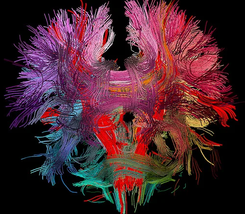 Rewiring. The peripheral and central nervous systems are functionally integrated regarding the consequences of a nerve injury: a peripheral nerve lesion always results in profound and long lasting central modifications and reorganization. (Kaas, 1991) Does there need to be a lesion though ? A functional lesion will force changes just like an ablative lesion. Altered gait that persists from a sprained ankle or a painful knee will force central modifications and reorganization. This is why resolution of pain and aberrant function is critical. If you rehab to 80% you leave 20% on the table and that gets rewired into the system as the new norm. Remember, the entire system is watching, learning, adapting and rewiring all the time. This is why you must have a team in place to resolve all, if possible, of your client’s deficits. If you leave 20% of a problem on the table, and add endurance and strength to the “80%resolved:20%remaining”, you reorganize the central nervous system with that as the assumed norm moving forward. From this point forward, this is the architecture that all new patterns and forms are built from. This sets up for long term rewiring of all of the connected parts, from motor, sensory, visual, gait, proprioceptive, vestibular and the list goes on and on. If you have ever wondered how a client can have so many areas of pain and dysfunction you might want to go back into their history and ask them if there was a single injury or event that occurred after which all their new problems started to stack up. If you are a gait analysis junkie, remember this principle above. All of the things you see in a person’s gait are not unconnected in many cases. Much of what you see is a compensation around their problems, not the actual problem. Remember this principle: the peripheral nervous system attempts to repair by regrowth, the central nervous system attempts to repair by re-routing and reorganizing. Dr. Shawn Allen